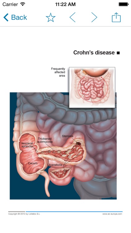 Miniatlas Gastroenterology screenshot-3