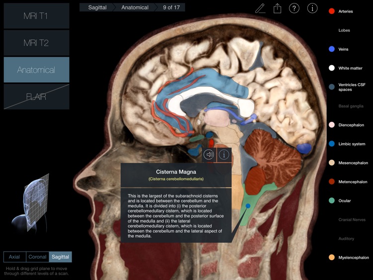 Radiology - Head