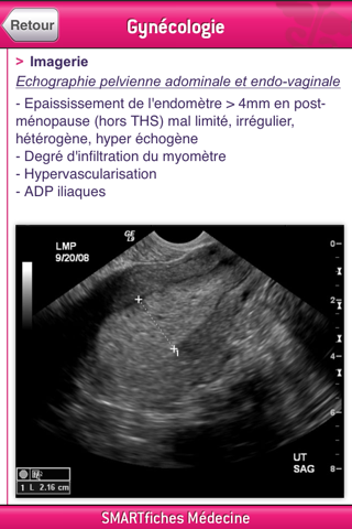 SMARTfiches Gynécologie Free screenshot 3