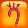 Aortic Aneurysm