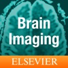 Brain Imaging Case Review