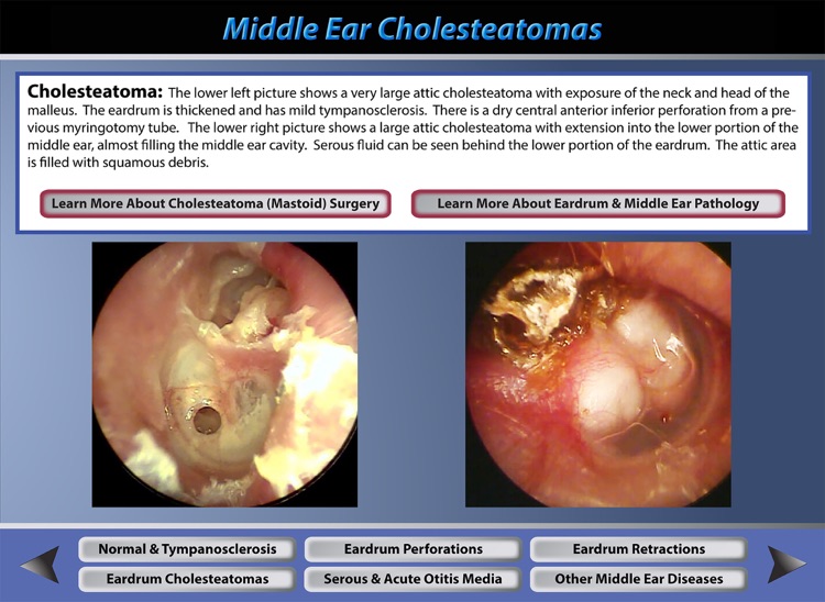 Ear Pathology
