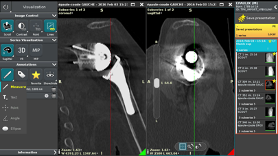 Screenshot #3 pour Anywhere Streaming