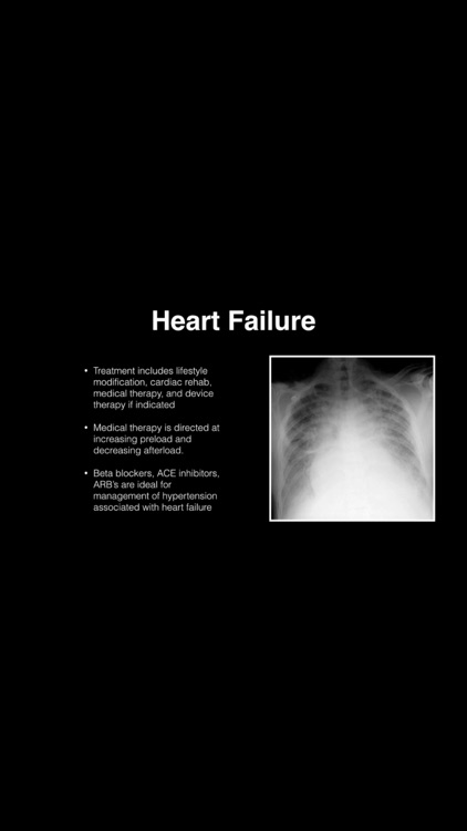 Cardiovascular Blueprint PANCE PANRE Review Couse screenshot-3
