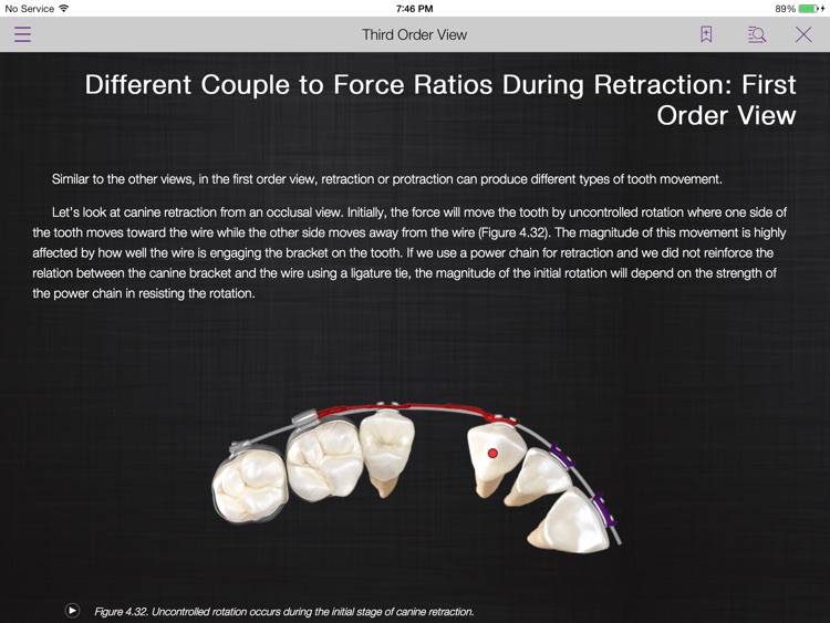 Mechanotherapy in Orthodontics Vol.1 screenshot-3