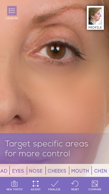 FaceLift: Cosmetic Surgery Simulator + Perfect Skin + Anti-Aging Visualizer