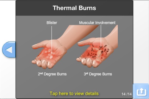 Understanding Hyperbaric Oxygen Therapy screenshot 2