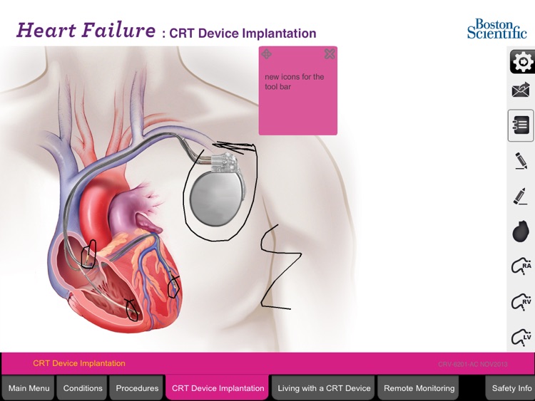 CardioTeach for iPad