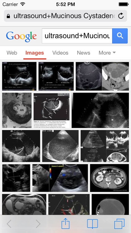 Ultrasound + screenshot-3