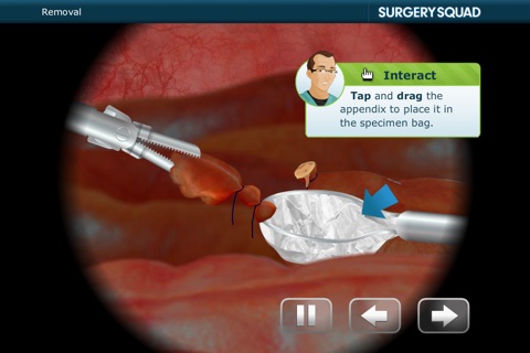 Surgery Squad's Virtual Appendectomy screenshot 2