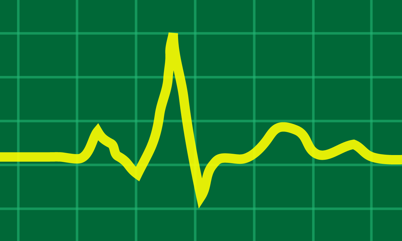 System Activity Monitor for TV