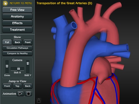 3D Road Map to Congenital Heart Disease screenshot 4