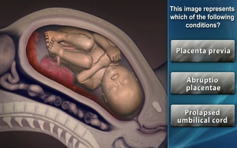 Medrills: Obstetrical Emergencies screenshot 2