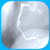 CARDIO3® Atlas of Interventional Cardiology – Lite - iPadアプリ