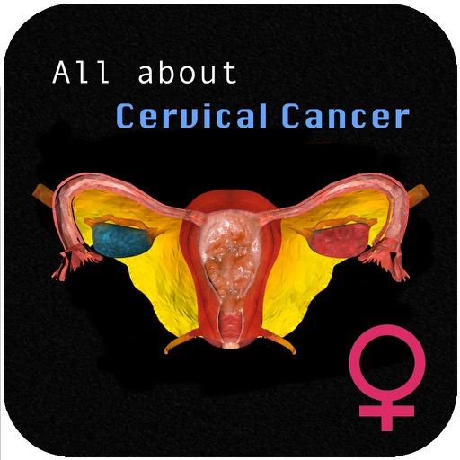 All about Cervical Cancer