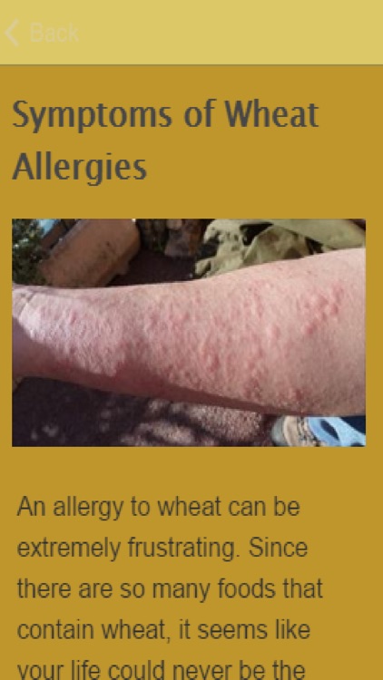 Symptoms Of Wheat Allergy