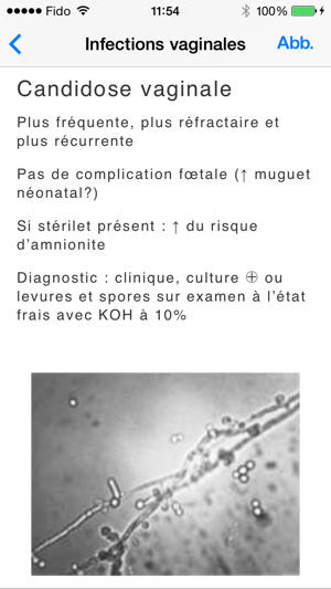 Mémo - Périnatalité(圖2)-速報App