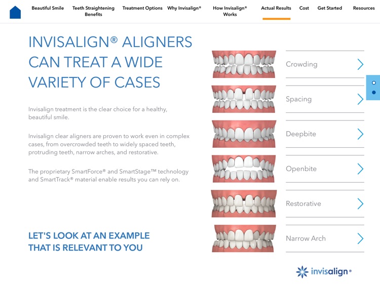 Invisalign Dentist Consultation App screenshot-3