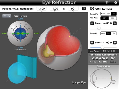 Eye Refraction screenshot 2