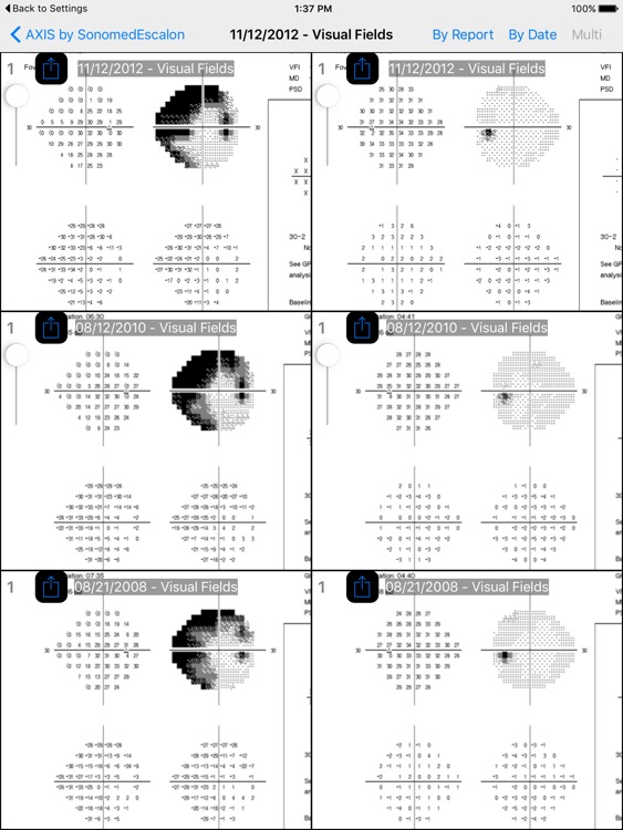SonomedEscalon Axis screenshot-4