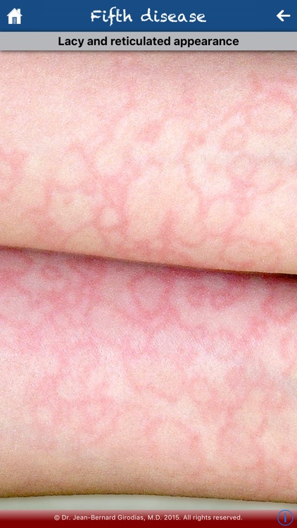 Rash screenshot-3