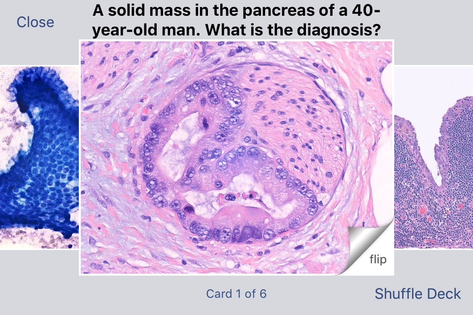 Johns Hopkins Flashcards screenshot 3