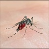 Zika Virus Infection