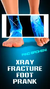 Xray Fracture Foot Prank screenshot #1 for iPhone