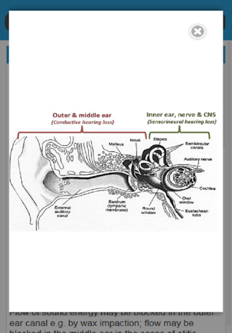 Audiology and Hearing Aids for Otolaryngologist screenshot 3