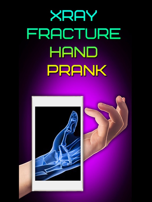 Screenshot #4 pour Xray Fracture Hand Prank