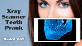 Game screenshot Xray Scanner Teeth Prank hack