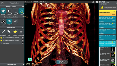 Screenshot #1 pour Anywhere Streaming