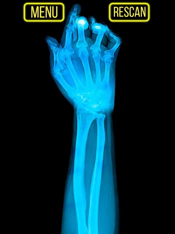 Screenshot #5 pour Xray Fracture Hand Prank