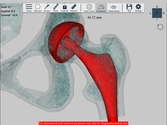 Ossa 3D iPad screenshot 5 - Medical app