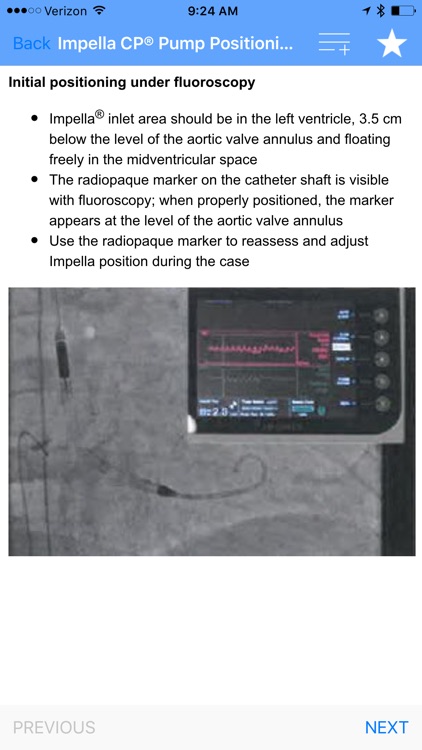 Impella App