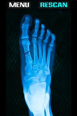 Game screenshot Xray Fracture Foot Prank apk