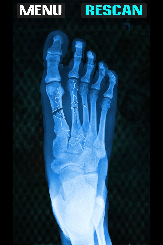 Xray Fracture Foot Prank screenshot 2