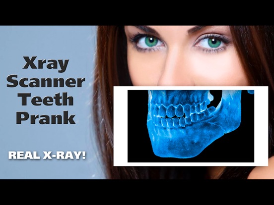 Screenshot #6 pour Xray Scanner Teeth Prank