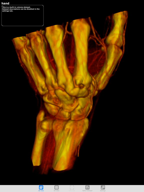 Screenshot #4 pour ImageVis3D Mobile Universal
