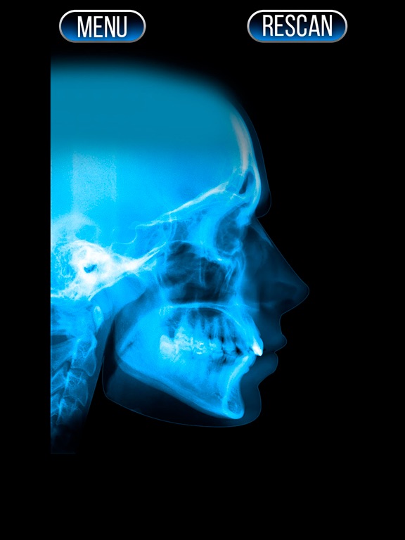 Screenshot #6 pour Xray Scanner Nose Prank