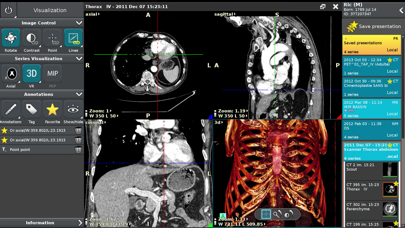 Screenshot #2 pour Anywhere Streaming