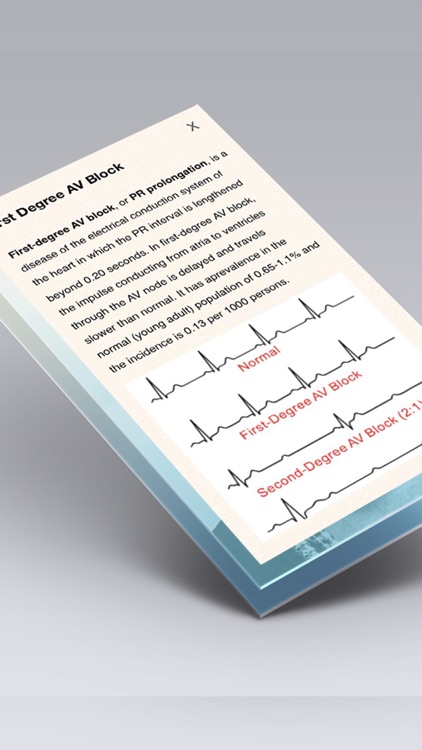 ECG Books - Cardiology Textbooks and Examples