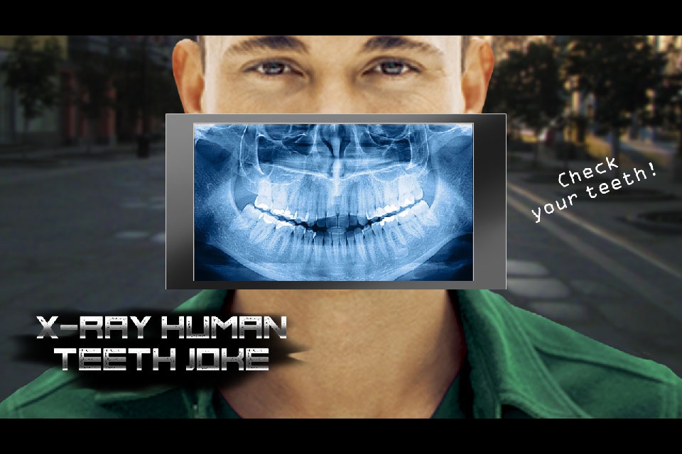 X-Ray Human Teeth Joke screenshot 3