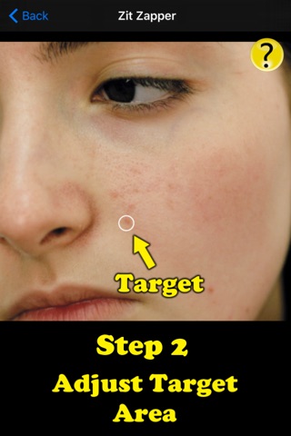 Zit Zapper Pro - Acne Remover screenshot 3