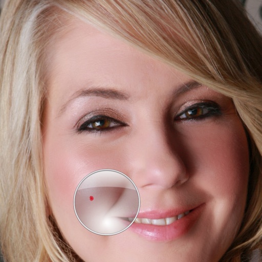 Zit Zapper Pro - Airbrush your face and remove pimples and acne