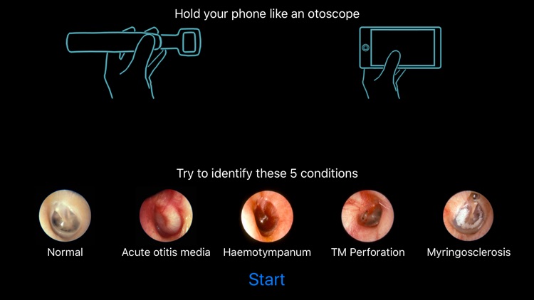 Otoscope Simulator