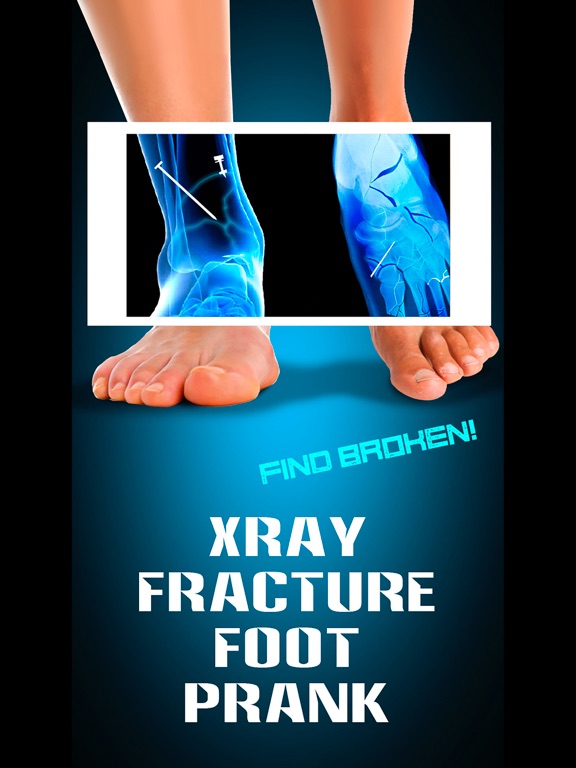 Screenshot #4 pour Xray Fracture Foot Prank
