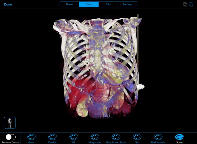 BodyViz