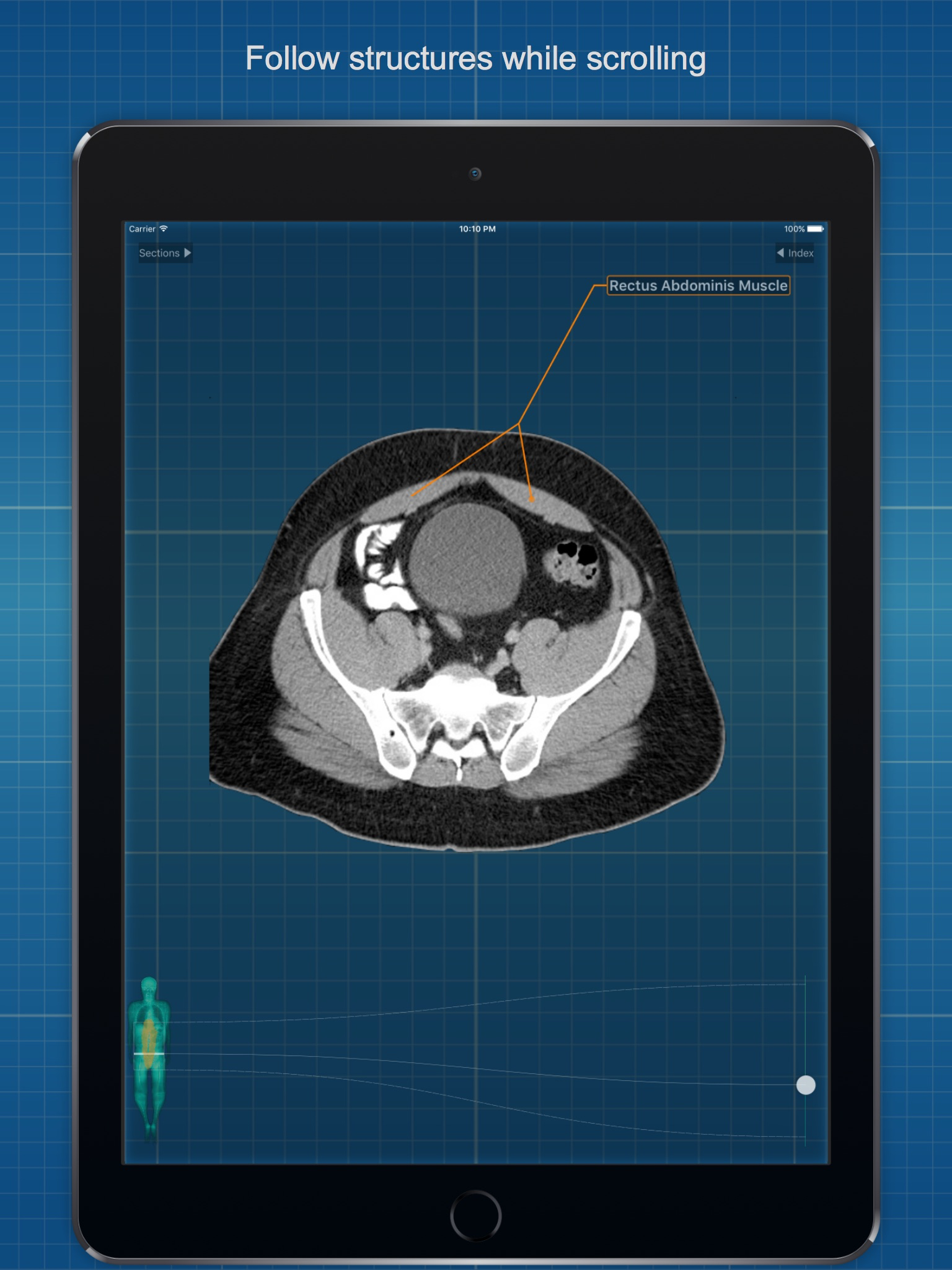X-Anatomy Basic