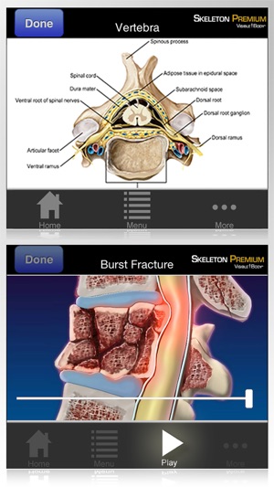 Skeleton Premium(圖5)-速報App